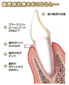 歯周病治療